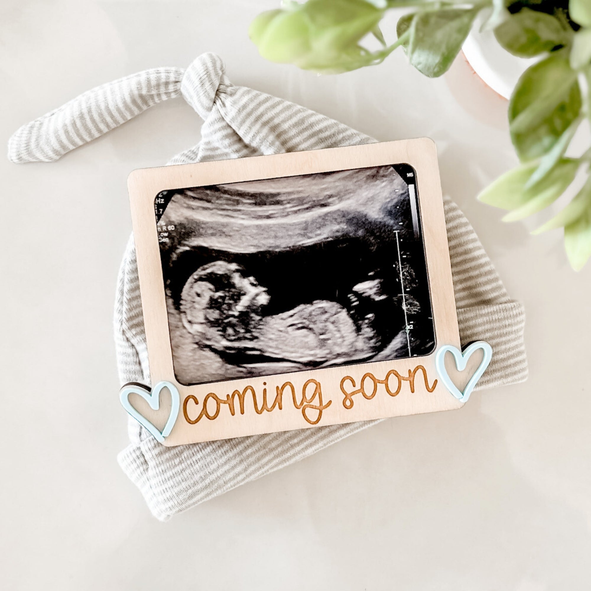 Coming Soon Ultrasound Magnet image 0